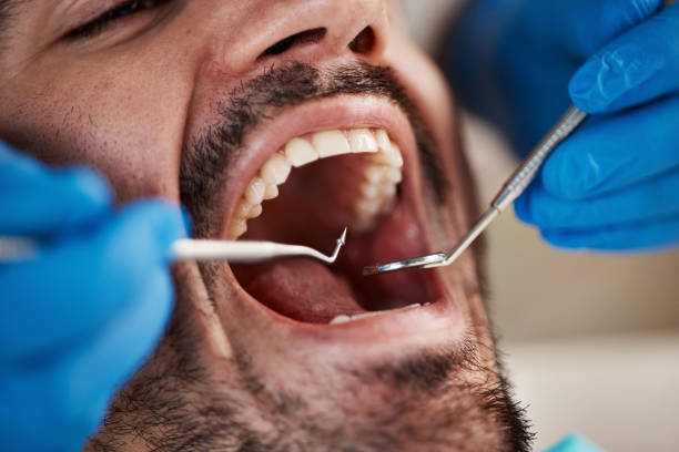 Best Emergency Treatment for Toothache in New Haven, CT